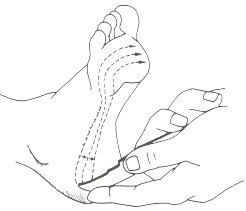 Plantar response Babinski test during lower limb neurological examination OSCE